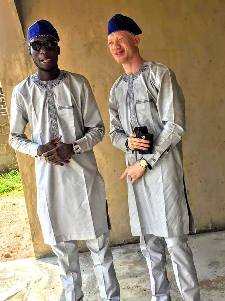 Unusual Occurrence Of Mixed Albino Twins In Nigeria