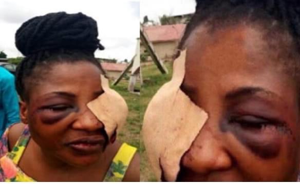 Married man redesigns his side chick’s face for coming to his house without telling him