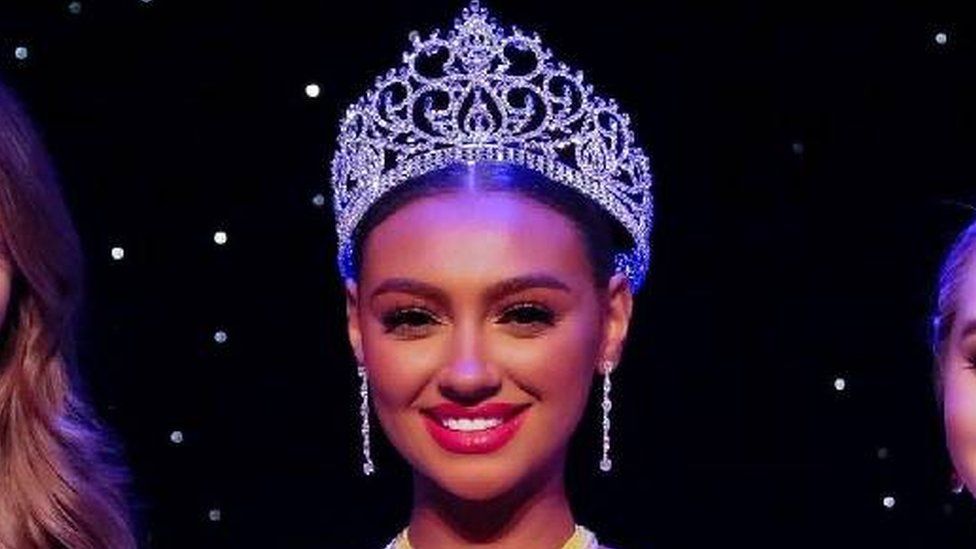 Miss Wales hospitalised with serious injuries following car crash