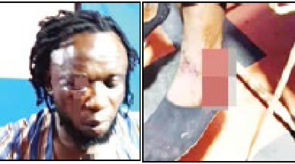 How Ebonyi artiste was beaten over campaign song