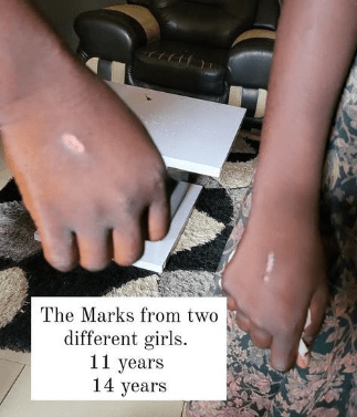 Snake bite: Latest cult initiation mark, rampant among students in Asaba