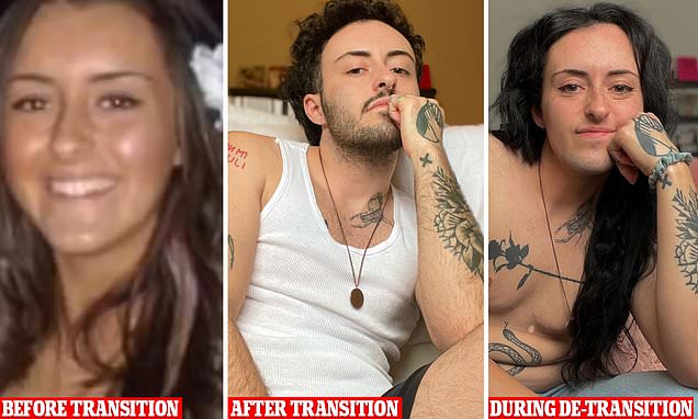 US transgender who removed breasts as a teen plans to get her breasts back, warns trans-girls