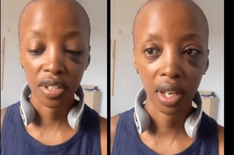 Black SA Teacher Assaulted At School in China, Left With Black Eye