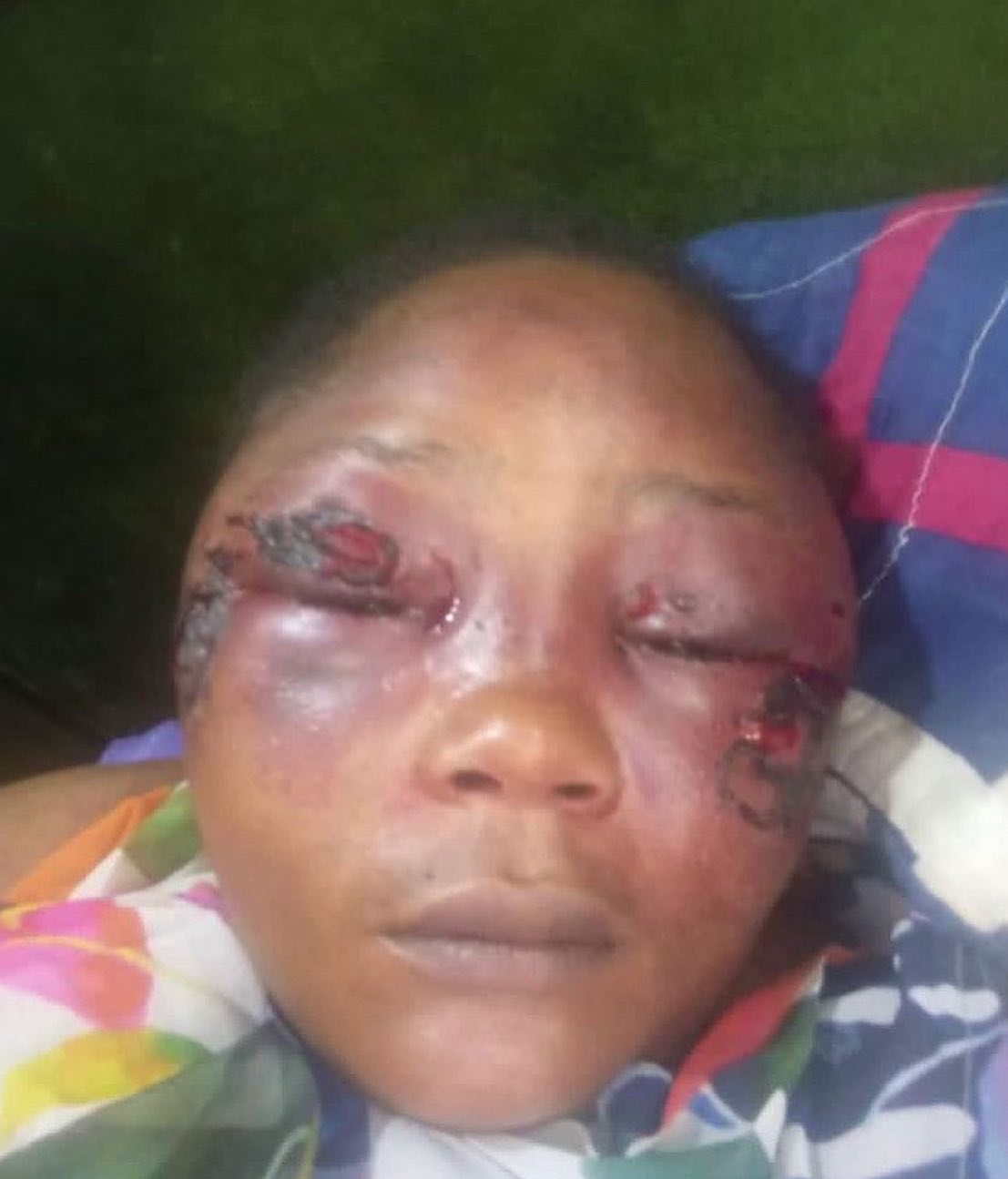 Moment robber attacks, damages lady’s face with spanner in Abuja