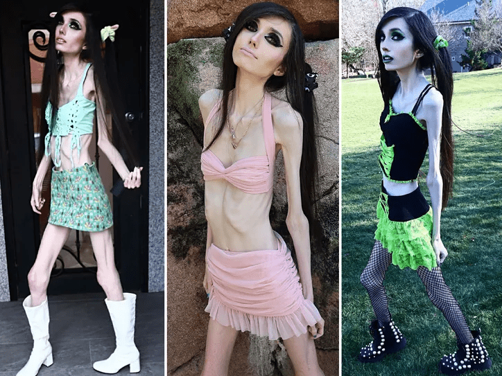 Fans concerned over youtuber, Eugenia Cooney's skinny appearance