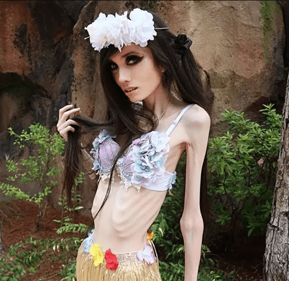 Fans concerned over youtuber, Eugenia Cooney's skinny appearance