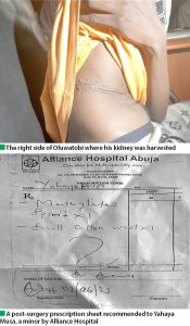 DailyTrust Exposes Abuja Kidney market Where The Rich Prey On The Poor