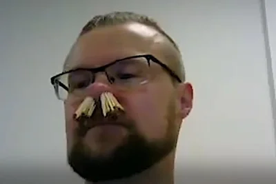 Man Sticks 68 Match-Sticks In His Nose To Break Guiness World Record