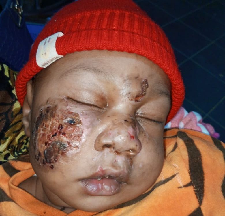 Father Demands Justice After His Baby Was Attacked On The First Day At Daycare